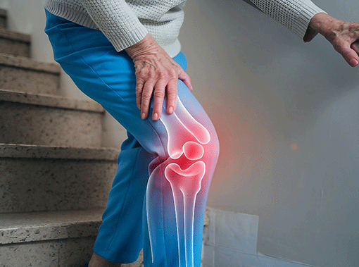 page img artrosi final