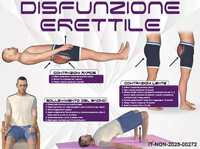 CARD Disfunzione Erettile Esercizi Fisici